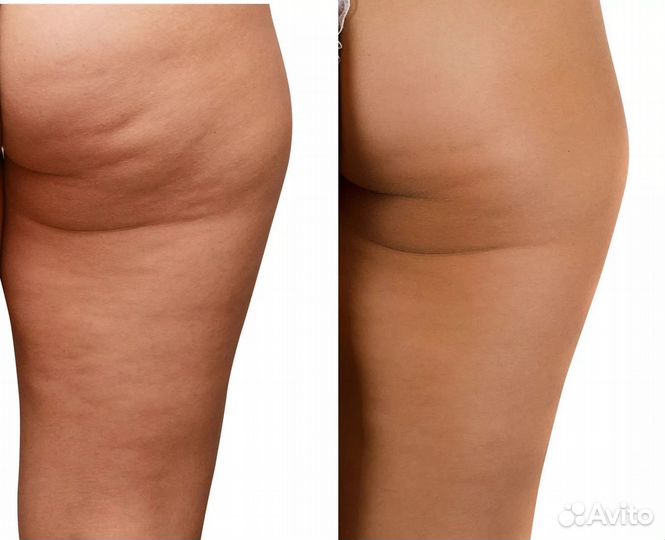 Массаж для женщин