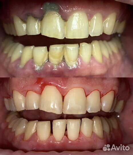 Гигиенист стоматологический