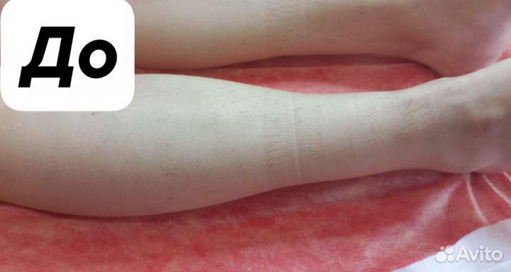 Шугаринг Ваксинг