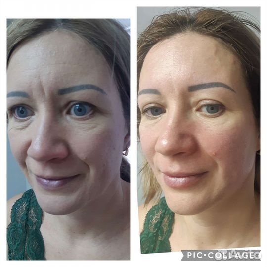 Массаж лица и тела