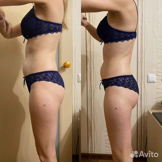 Антицеллюлитный массаж