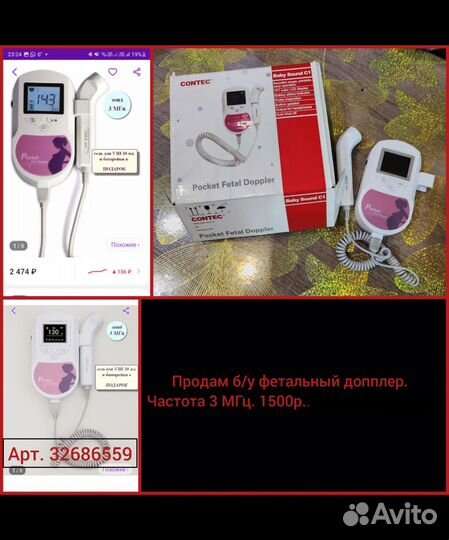 Фетальный допплер