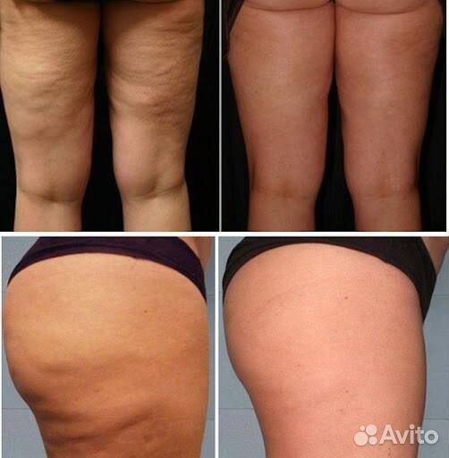 Щетка для сухого массажа