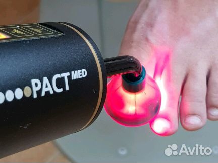 Медицинский педикюр Подология Вросший ноготь