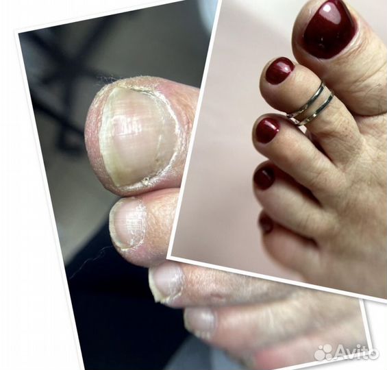 Маникюр, педикюр