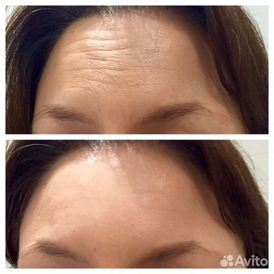 Услуги косметолога