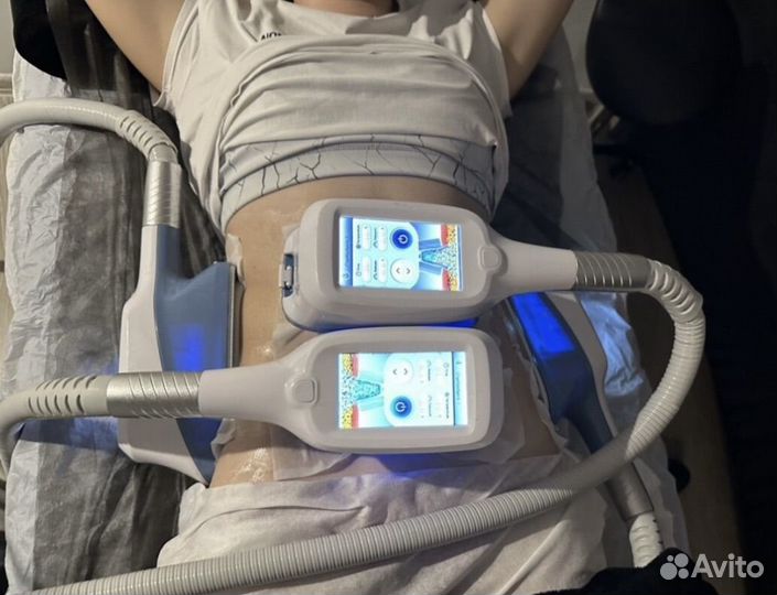 Абонемент на криолиполиз