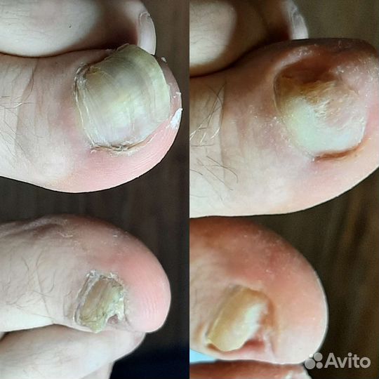 Мастер маникюра педикюра