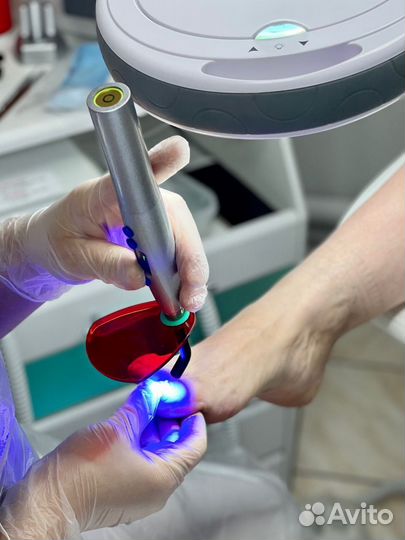 Подолог. Педикюр. Вросший ноготь. Мозоли. Грибок