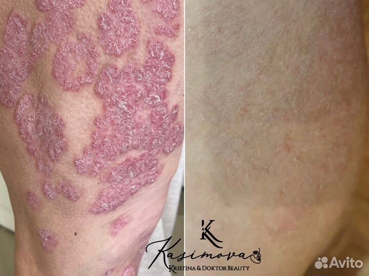 Врач- Дерматолог. Косметолог. Онколог