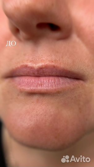 Модель на процедуру перманентного макияжа губ