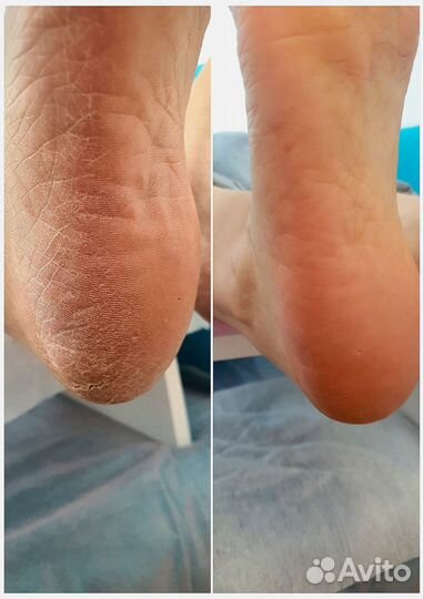 Педикюр, смарт педикюр, маникюр