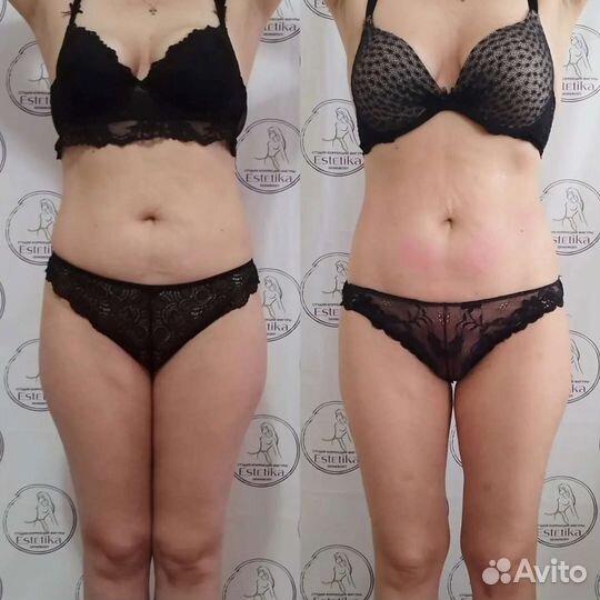 Массаж/ коррекция фигуры