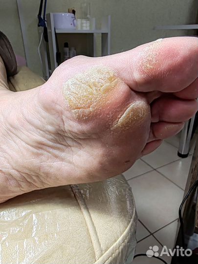 Модели на маникюр и педикюр