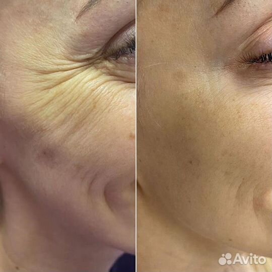 Услуги косметолога