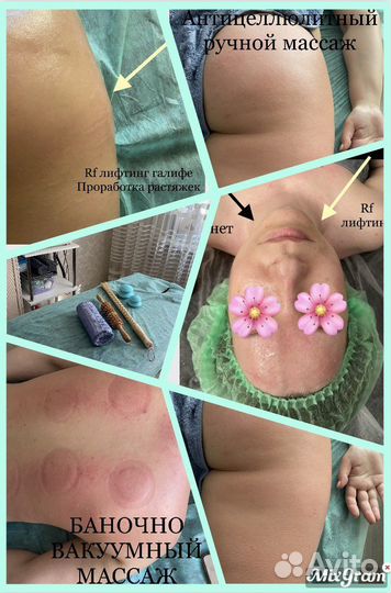 Антицеллюлитный, вакуумный, общий массаж