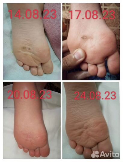 Клеточное питание