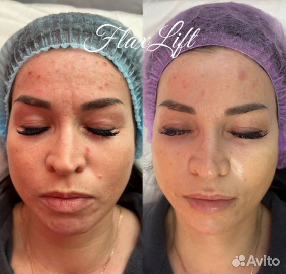 Услуги косметолога