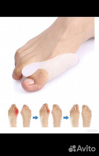 Силиконовый Фиксатор для большого пальца