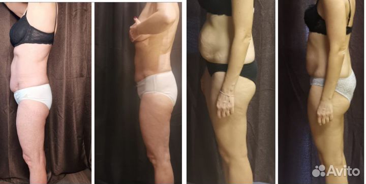 Массаж (коррекция фигуры) Только женщины