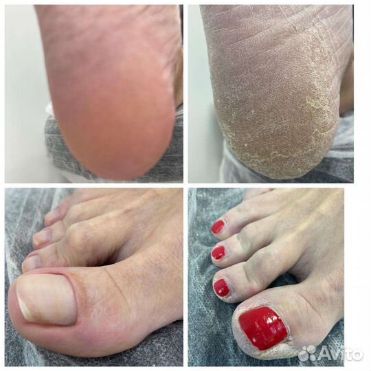 Подолог Педикюр мужской и женский