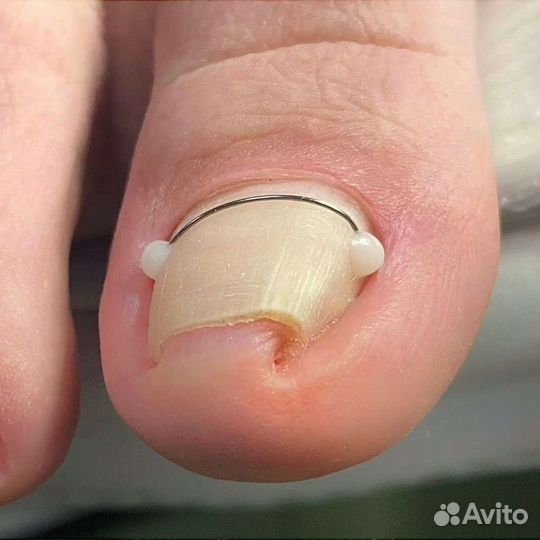 Подолог. Медицинский педикюр