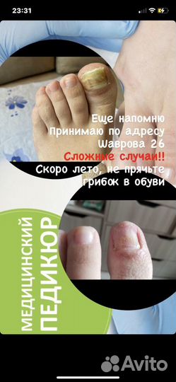 Маникюр/Педикюр/Подология