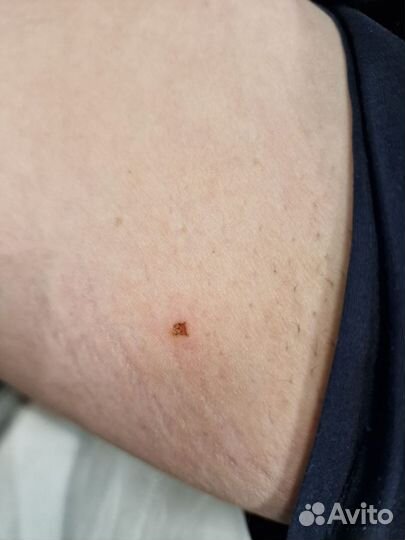 Аппаратная косметология