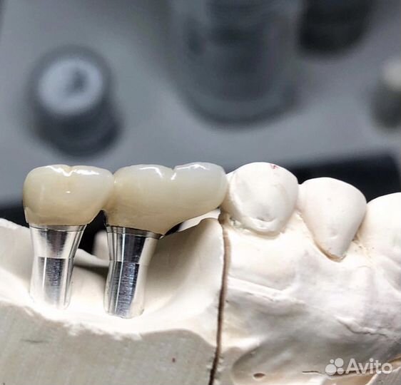 Зубной техник