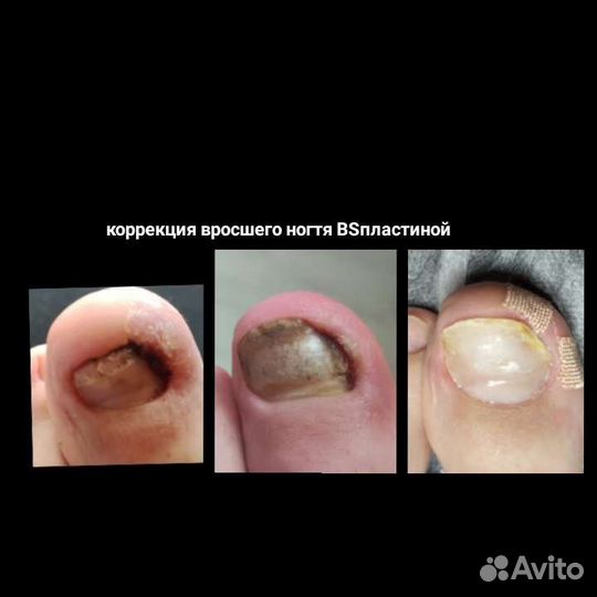 Мастер педикюра, подология