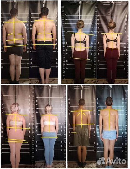 Массаж лечебный