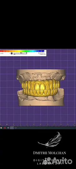 Зубной Техник
