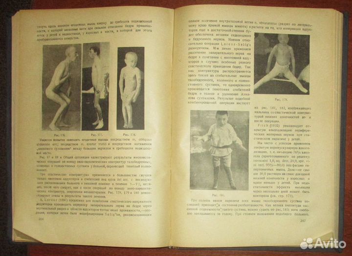 Фридланд М. О. Курс ортопедии. Часть II. Частная о