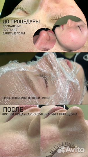 Услуги косметолога