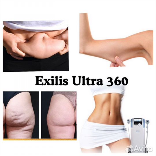Exilis Ultra 360 RF лифтинг тела похудение