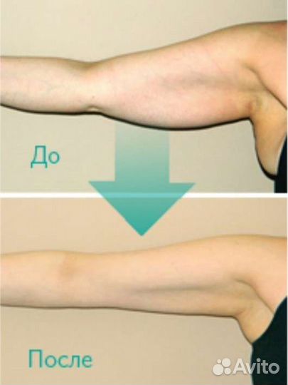 Коррекция фигуры