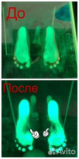 Инструктор лфк (вальгус, плоскостопие, сутулость)