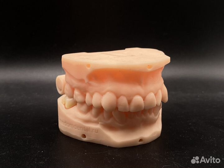 Коронка наготова от интраорального скана