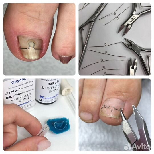 Подолог, педикюр