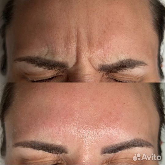 Услуги косметолога