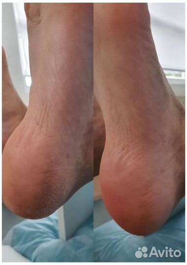 Педикюр, смарт педикюр, маникюр