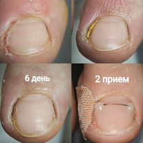 Педикюр любой сложности, Москва
