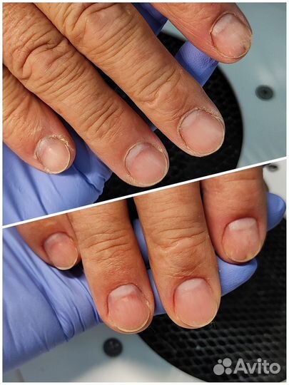 Подологический маникюр (мужской, женский, детский)