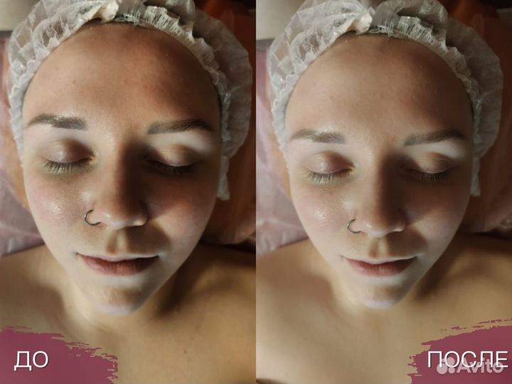 Косметолог. Массаж лица