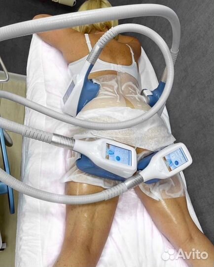 3D Криолиполиз в клинике м.Уралмаш