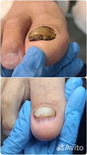 Подолог, мастер педикюра