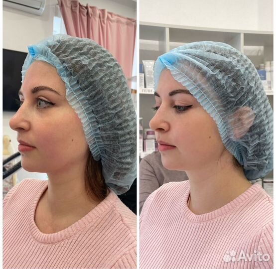 Массаж лица