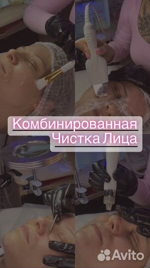 Модели Косметолог Чистка Пилинг Спб