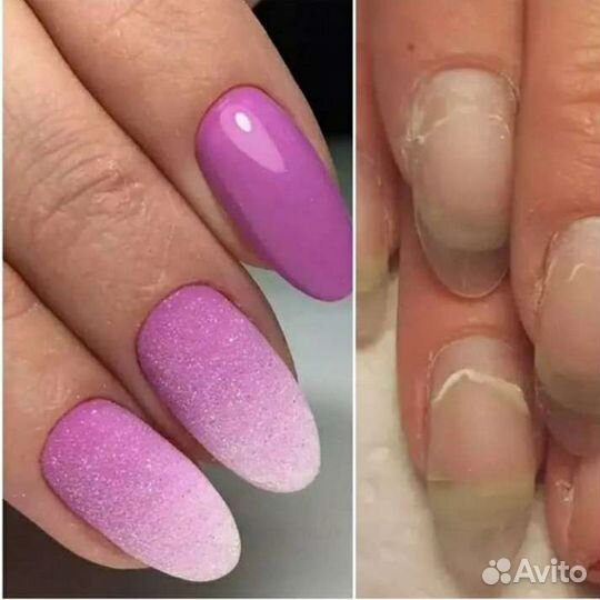 Маникюр педикюр наращивание ногтей