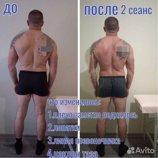 Лечебный массаж Остеопластика по метод Виталия Ким